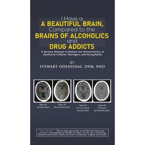 I Have a Beautiful Brain, Compared to the Brains of Alcoholics and Drug Addicts - Hardcover