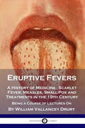 Eruptive Fevers: A History of Medicine - Scarlet Fever, Measles, Small-Pox and Treatments in the 19th Century - Being a Course of Lectures On - Paperback