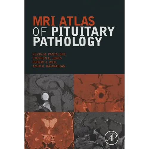 MRI Atlas of Pituitary Pathology - Hardcover