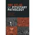 MRI Atlas of Pituitary Pathology - Hardcover