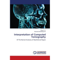 Interpretation of Computed Tomography - Paperback
