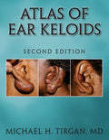 Atlas of Ear Keloids - Second Edition - Paperback