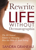 Rewrite Your Life Without Dermatographia: The All-Natural Solution to Managing Hive-Like Welts and Severe Itching - Paperback