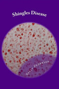 Shingles Disease: The Complete Guide - Paperback