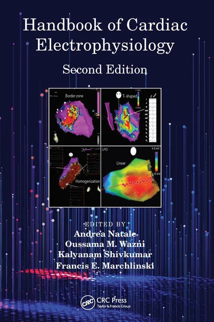 Handbook of Cardiac Electrophysiology - Paperback