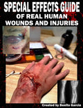 Special Effects Guide Of Real Human Wounds and Injuries: Special Effects Guide Of Real Human Wounds and Injuries - Paperback