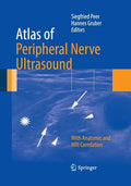 Atlas of Peripheral Nerve Ultrasound: With Anatomic and MRI Correlation - Paperback