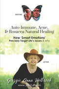 Auto-Immune, Acne, & Rosacea Natural Healing - How 'Smart Emotions' Precisely Target Life's Issues & Why - Paperback