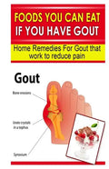 Foods You Can Eat If You Have Gout: Home Remedies for Gout That Work to Reduce Pain - Paperback