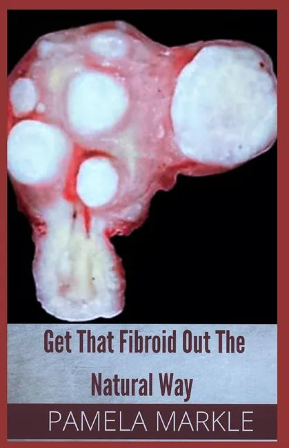 Get That Fibroid Out the Natural Way - Paperback