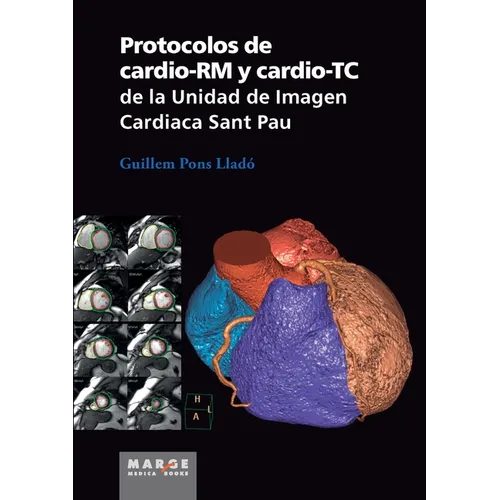 Protocolos de cardio-RM y cardio-TC de la Unidad de Imagen Cardiaca Sant Pau - Paperback
