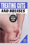 Treating Cuts and Bruises: A Book on Wound Care - Paperback