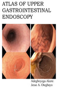 Atlas of Upper Gastrointestinal Endoscopy - Paperback