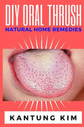DIY Oral Thrush Natural Home Remedies: The Effective Step By Step Guide To Permanently End Oral Thrush - Paperback