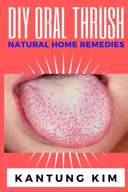 DIY Oral Thrush Natural Home Remedies: The Effective Step By Step Guide To Permanently End Oral Thrush - Paperback