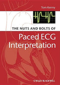 The Nuts and Bolts of Paced ECG Interpretation - Paperback