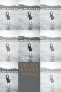 Skint Knees: Reflections on a Scottish Childhood - Paperback