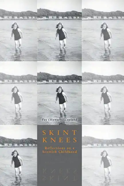 Skint Knees: Reflections on a Scottish Childhood - Paperback