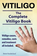 Vitiligo. Vitiligo causes, remedies, costs and treatment all included. The complete Vitiligo Book. - Paperback