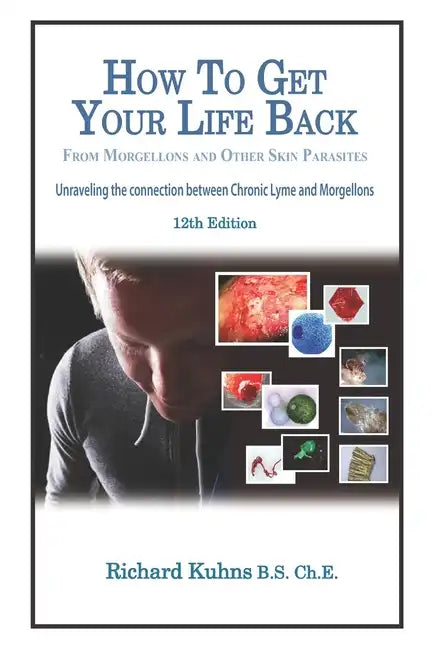 How to Get Your Life Back From Morgellons and Other Skin Parasites Limited Edit - Paperback