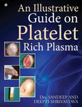 An Illustrative Guide on Platelet Rich Plasma - Paperback