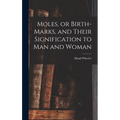 Moles, or Birth-marks, and Their Signification to Man and Woman - Hardcover