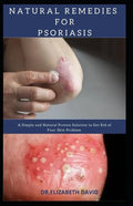 Natural Remedies for Psoriasis: A Simple and Natural Proven Solution to Get Rid of Your Skin Problem: Dermatitis, Eczema, Psoriasis & Rosacea and Othe - Paperback