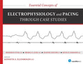 Essential Concepts of Electrophysiology and Pacing Through Case Studies - Paperback
