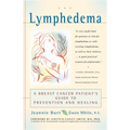 Lymphedema: A Breast Cancer Patient's Guide to Prevention and Healing - Paperback