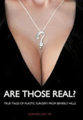 Are Those Real?: True Tales of Plastic Surgery from Beverly Hills - Hardcover