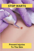 Stop Warts: Prevent Injuries To The Skin: Warts Treatment Near Me - Paperback