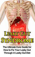 Leaky Gut Syndrome: The Ultimate Cure Guide for How to Fix Your Leaky Gut Through A Leaky Gut Diet - Paperback