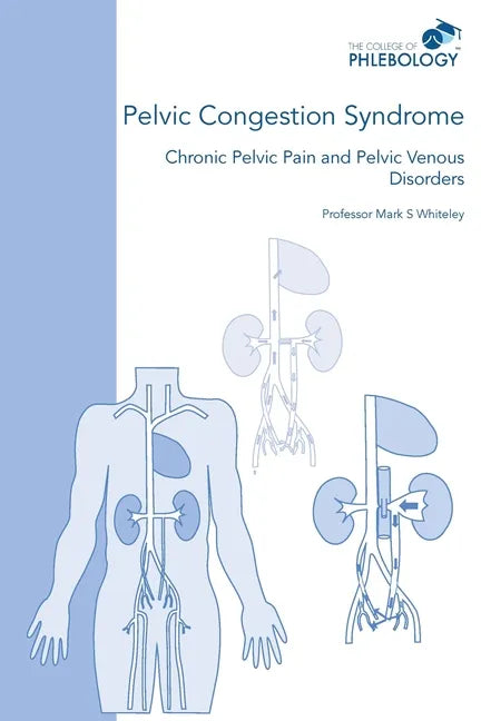 Pelvic Congestion Syndrome - Chronic Pelvic Pain and Pelvic Venous Disorders - Paperback