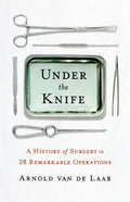 Under the Knife - Paperback