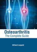 Osteoarthritis: The Complete Guide - Hardcover