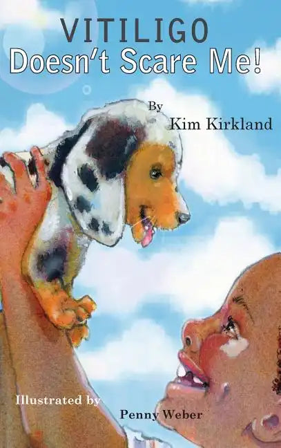 Vitiligo Doesn't Scare Me - Hardcover