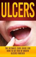 Ulcers: The Ultimate Cure Guide for How to Get Rid of Mouth Ulcers Instantly - Paperback