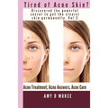 TIRED OF ACNE SKIN? Discover the Powerful Secrets to get Clearer Skin Permanently - Paperback