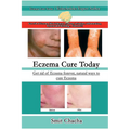 Eczema Cure Today - Get rid of Eczema forever natural ways to cure Eczema - Paperback