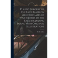 Plastic Surgery of the Face Based on Selected Cases of war Injuries of the Face Including Burns, With Original Illustrations - Hardcover