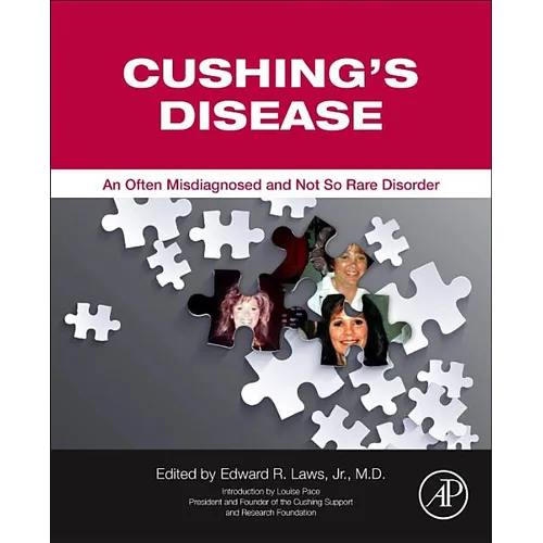 Cushing's Disease: An Often Misdiagnosed and Not So Rare Disorder - Paperback