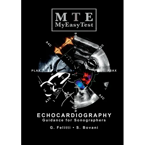 Echocardiography - MyEasyTest - Paperback