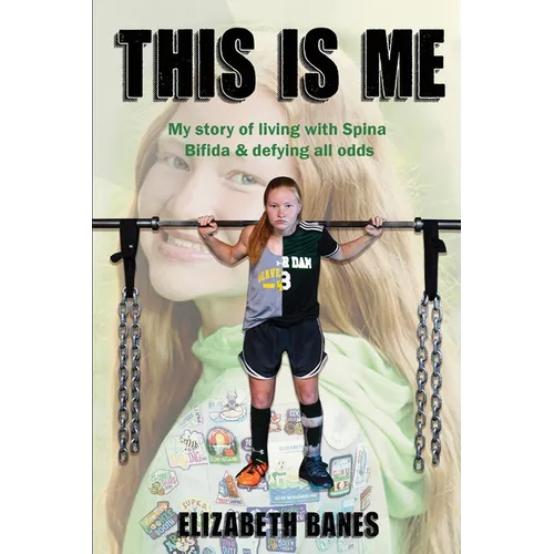 This Is Me: My story of living with Spina Bifida & defying all odds - Paperback
