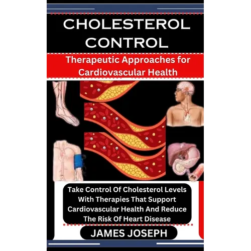 Cholesterol Control: Therapeutic Approaches for Cardiovascular Health: Take Control Of Cholesterol Levels With Therapies That Support Cardi - Paperback