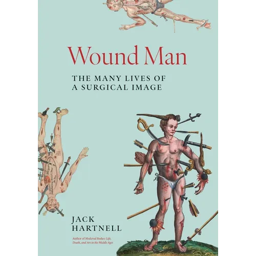 Wound Man: The Many Lives of a Surgical Image - Hardcover