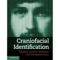Craniofacial Identification - Hardcover