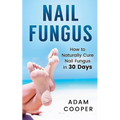 Nail Fungus: How to Naturally Cure Nail Fungus in 30 Days: Natural remedies, homeopathy for toenail fungus - Paperback