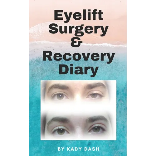 Eyelift Surgery and Recovery Diary: Ptosis, eyelifts, punctal plugs, and dry eyes - Paperback