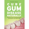 Cure Gum Disease Naturally: Heal Gingivitis and Periodontal Disease with Whole Foods - Paperback