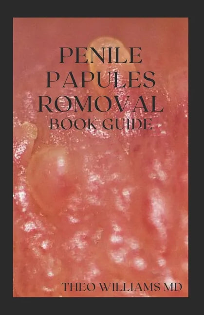 Penile Papules Romoval Book Guide: The Ultimate Guide On How To Remove Pearly Penile Papules Using Natural Remedies - Paperback
